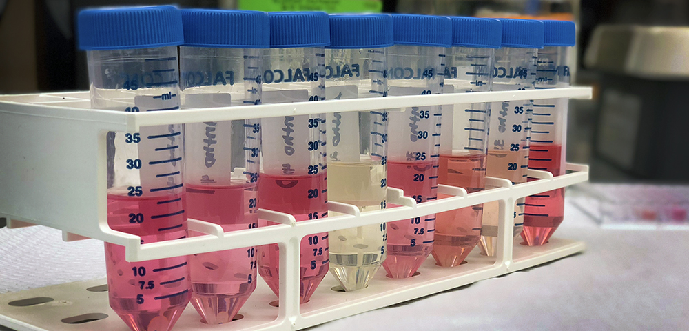 Samples varying for anthocyanin content