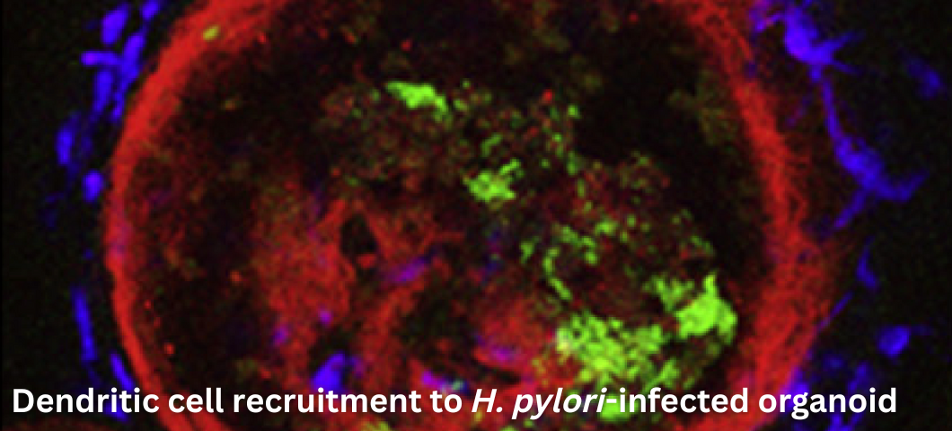 Dendritic cell recruitment to H. pylori-infected organoid