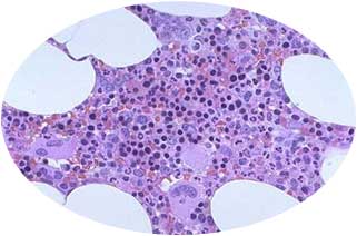 Bone Marrow