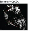 Principles of ureolysis-induced mineral precipitation. Reaction scheme and images of microbes and calcium carbonate on sand grains. (A. Phillips, A. Cunningham, L. Spangler, R. Gerlach)