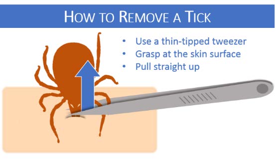 How to remove a tick