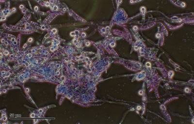 Microscopic image of Pythium