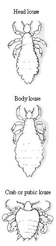 Louse