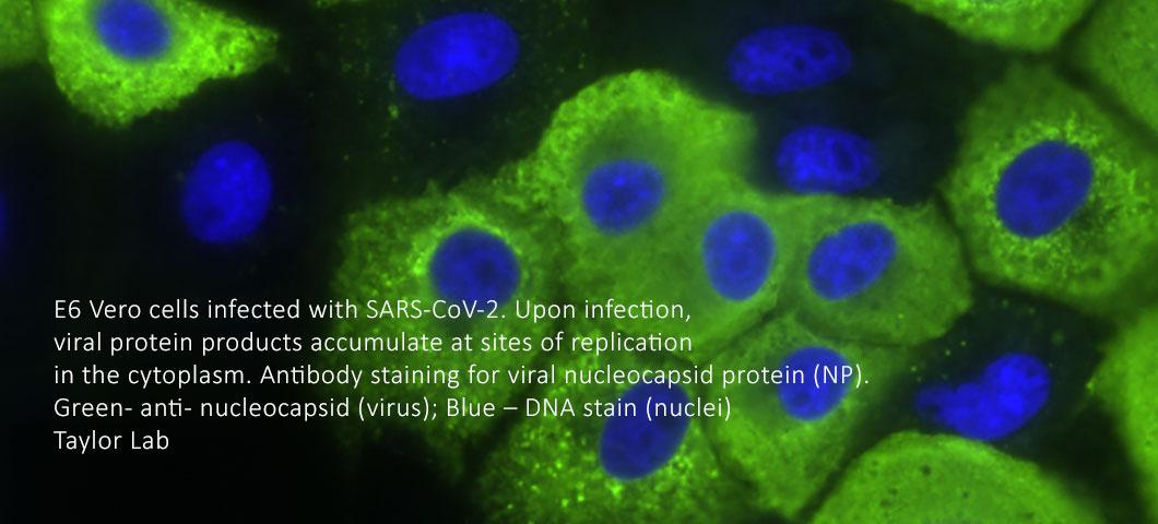 E6 Vero cells infected with SARS-CoV-2. Upon infection,
viral protein products accumulate at sites of replication
in the cytoplasm. Antibody staining for viral nucleocapsid protein (NP).
Green- anti- nucleocapsid (virus); Blue – DNA stain (nuclei)
Taylor Lab 