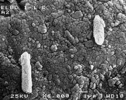 Dry Valley Lake Ice: Scanning Electron Micrographs