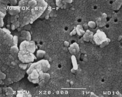 Vostok Ice Core (3590m): Scanning Electron and Atomic Force Micrographs