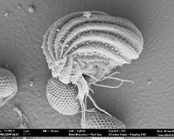 Scanning electron micrograph of microbe