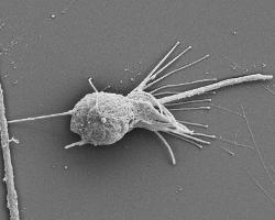 Scanning electron micrograph of microbe