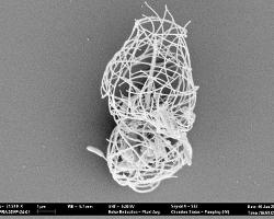 Scanning electron micrograph of microbe