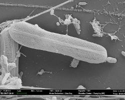Scanning electron micrograph of microbe