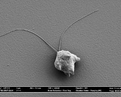 Scanning electron micrograph of microbe