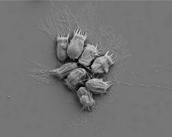 Scanning electron micrograph of microbe