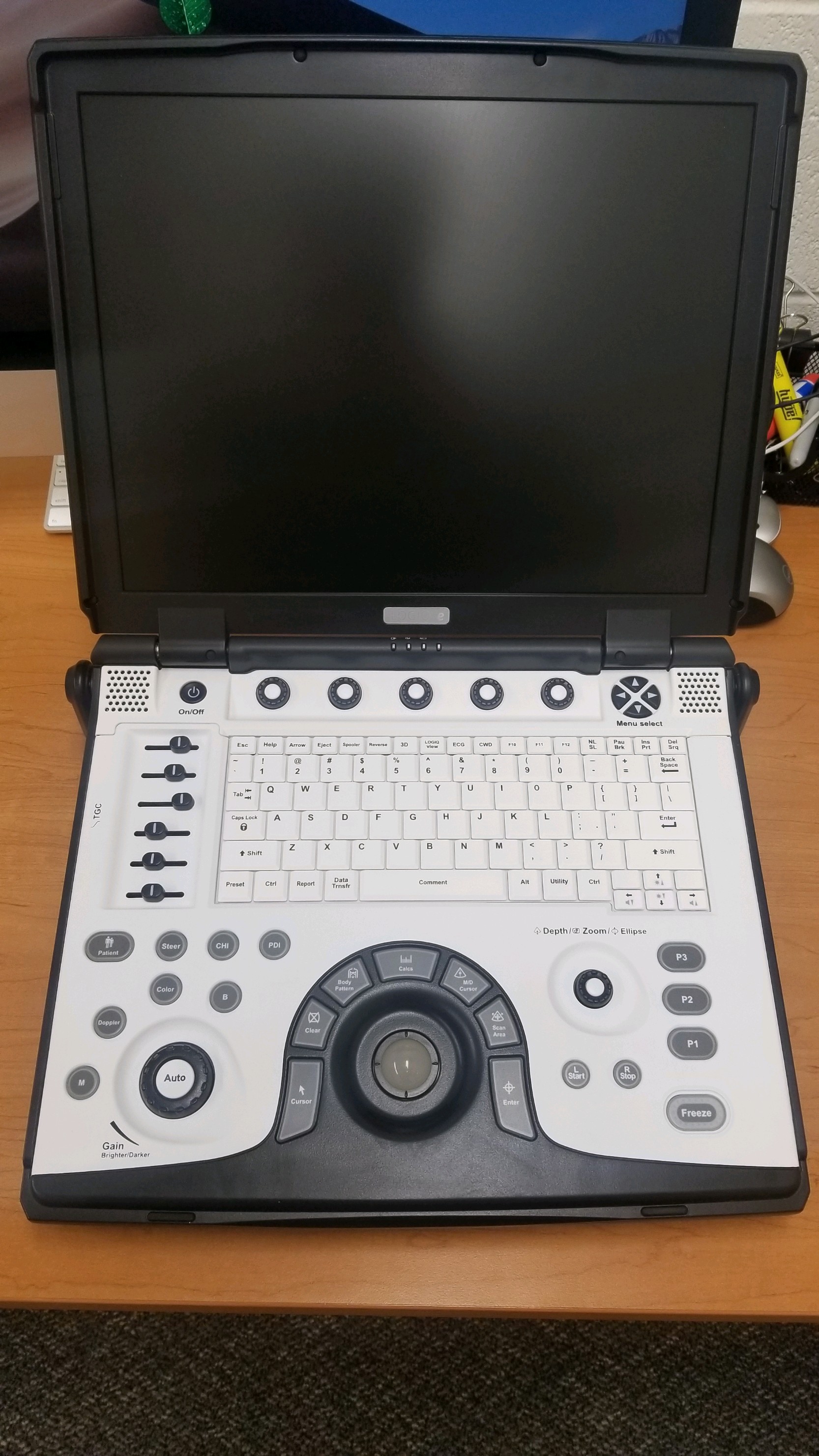 Laptop used with ultrasound